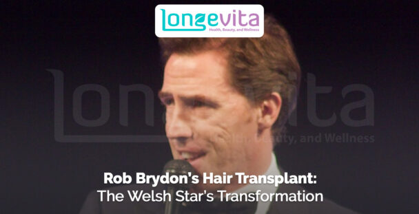 Rob Brydon speaking into microphone with headline about his hair transplant transformation