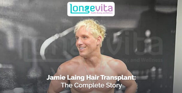 shirtless Jamie Laing smiling with text about his hair transplant journey