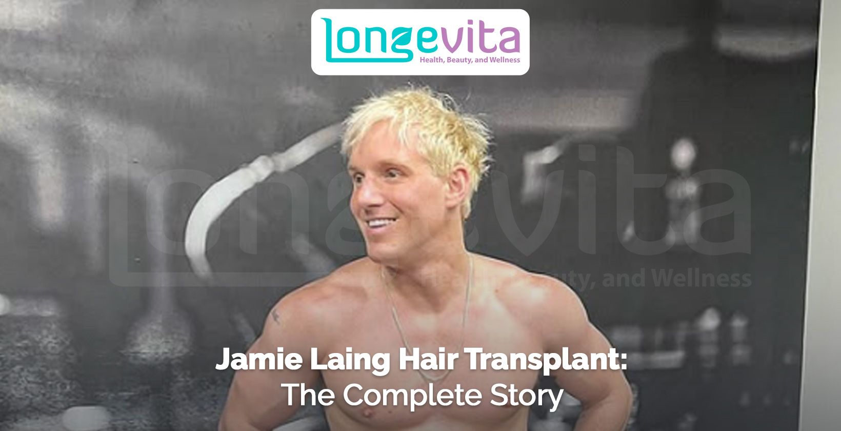 shirtless Jamie Laing smiling with text about his hair transplant journey