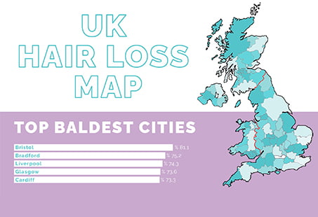 uk hair loss map