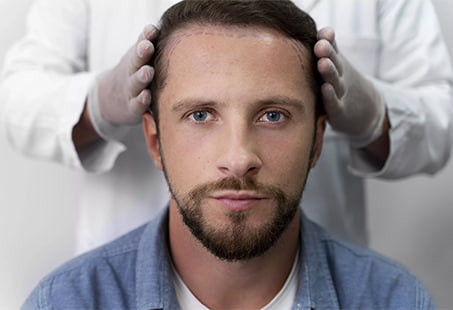 Is A Hair Transplant Worth It? 5 Reasons You Should Get It