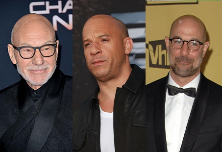 Famously Bald Actors With Luscious Hair