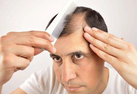 Sertraline Hair Loss: Why It Happens & How To Stop It? | Longevita