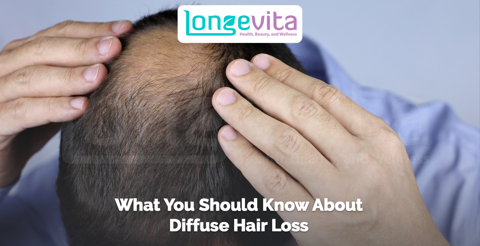 man examining thinning hair at crown with both hands, text about diffuse hair loss