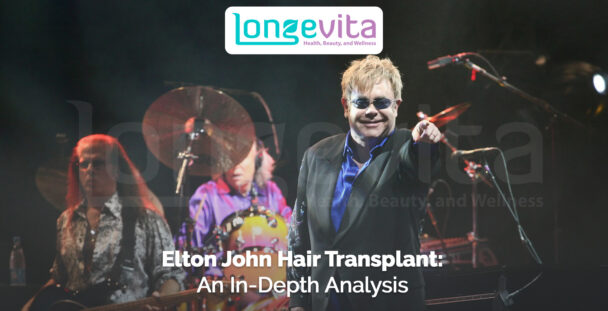 Elton John performing on stage with band, headline about his hair transplant