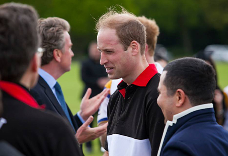 Prince William hair transplant