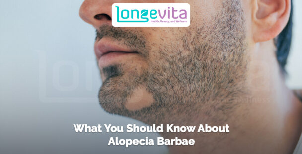 close-up of a man’s patchy beard with visible bald spots