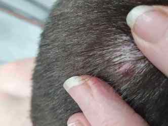 Scalp pimple after a hair transplant 3