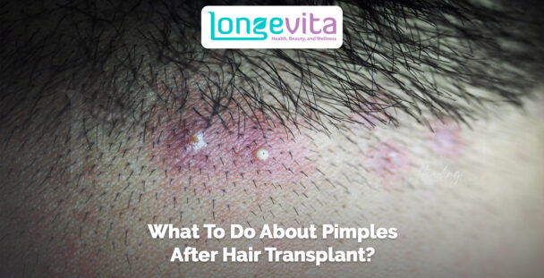 close-up of pimples and redness on scalp after hair transplant
