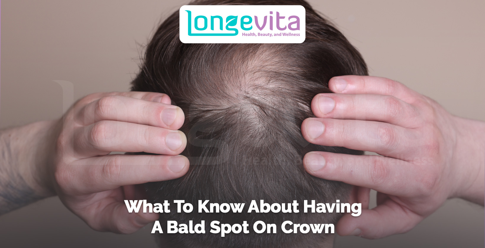 man parting hair to show bald spot on crown with text about hair loss