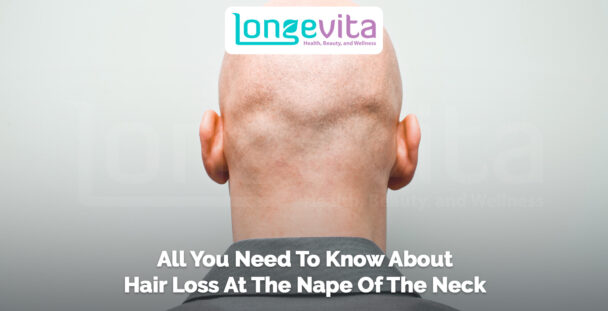 back view of a bald head with text about hair loss at the nape of the neck