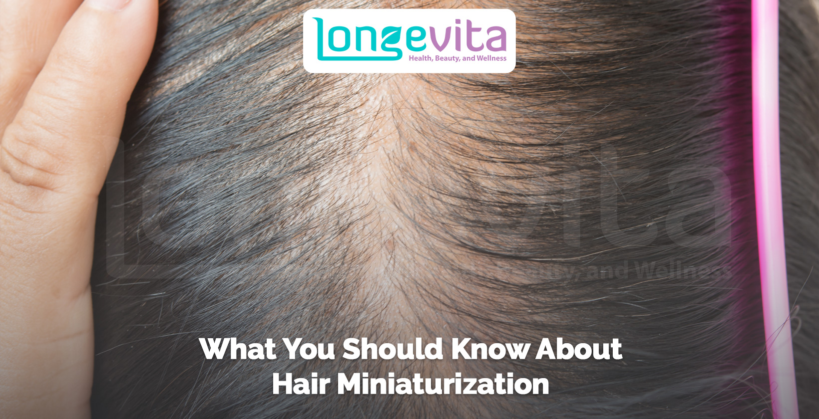 close-up of scalp with thinning hair parted to show hair miniaturization