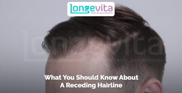 close-up of a man’s forehead showing a receding hairline with text about hair loss