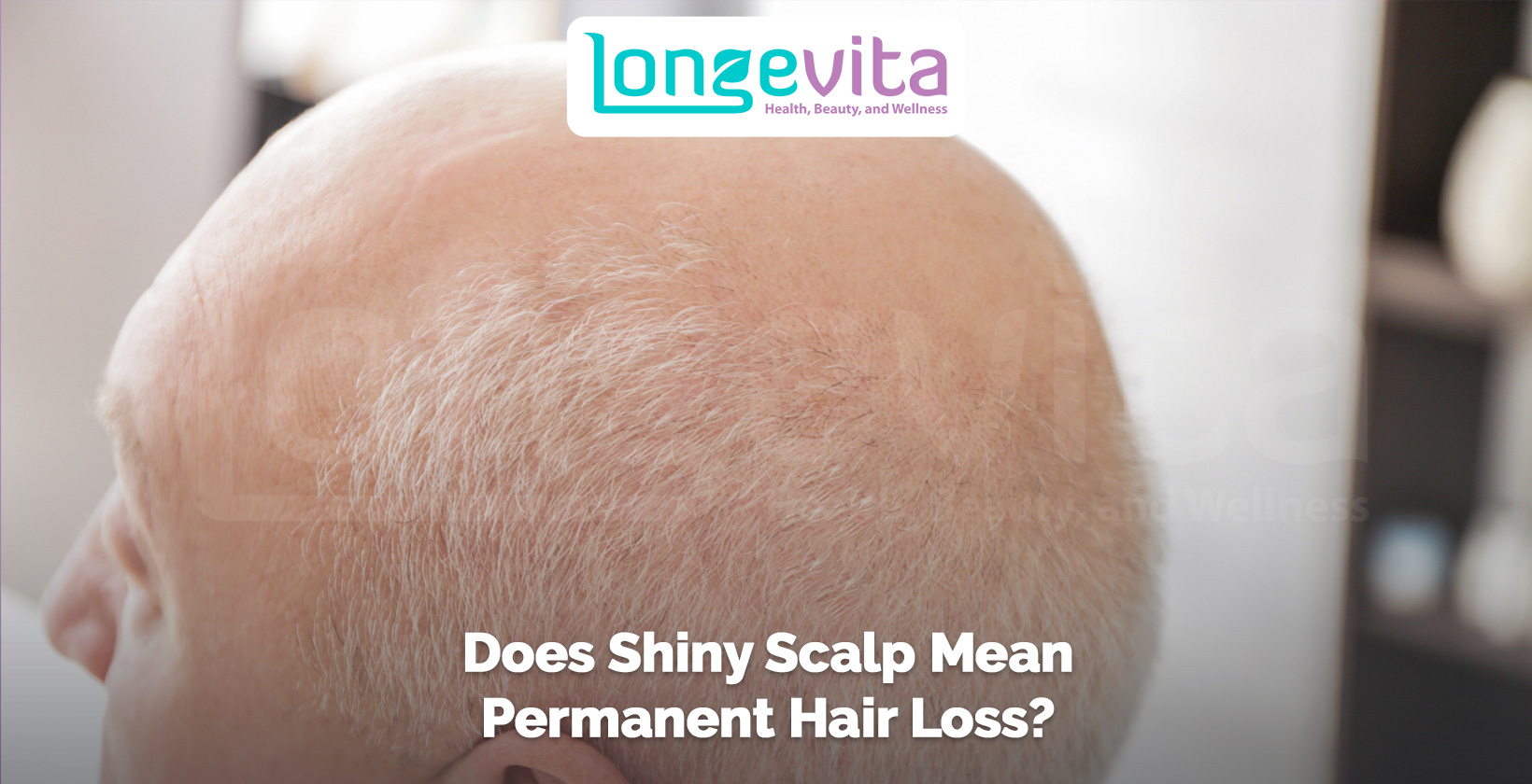 bald shiny scalp with text asking if it means permanent hair loss