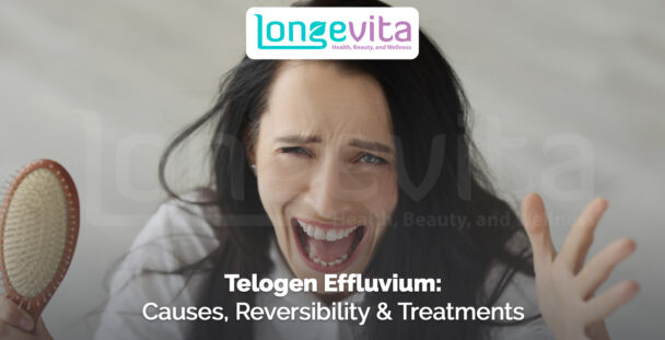 distressed woman holding a hairbrush and clumps of hair with text about telogen effluvium