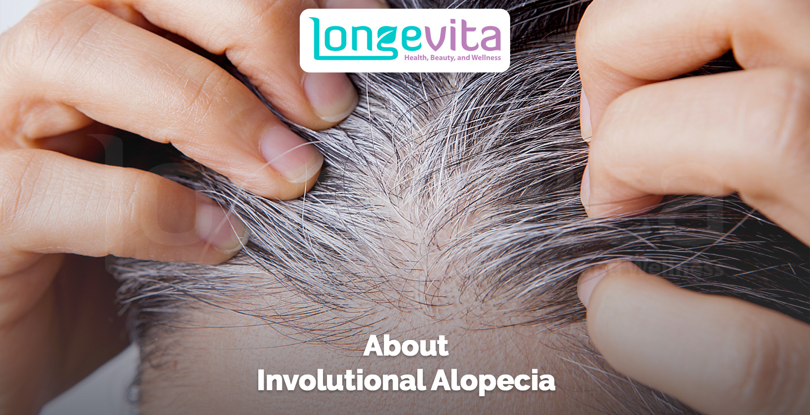 close-up of hands parting gray thinning hair with text about involutional alopecia