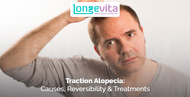 man lifting his hairline to show thinning scalp with text about traction alopecia