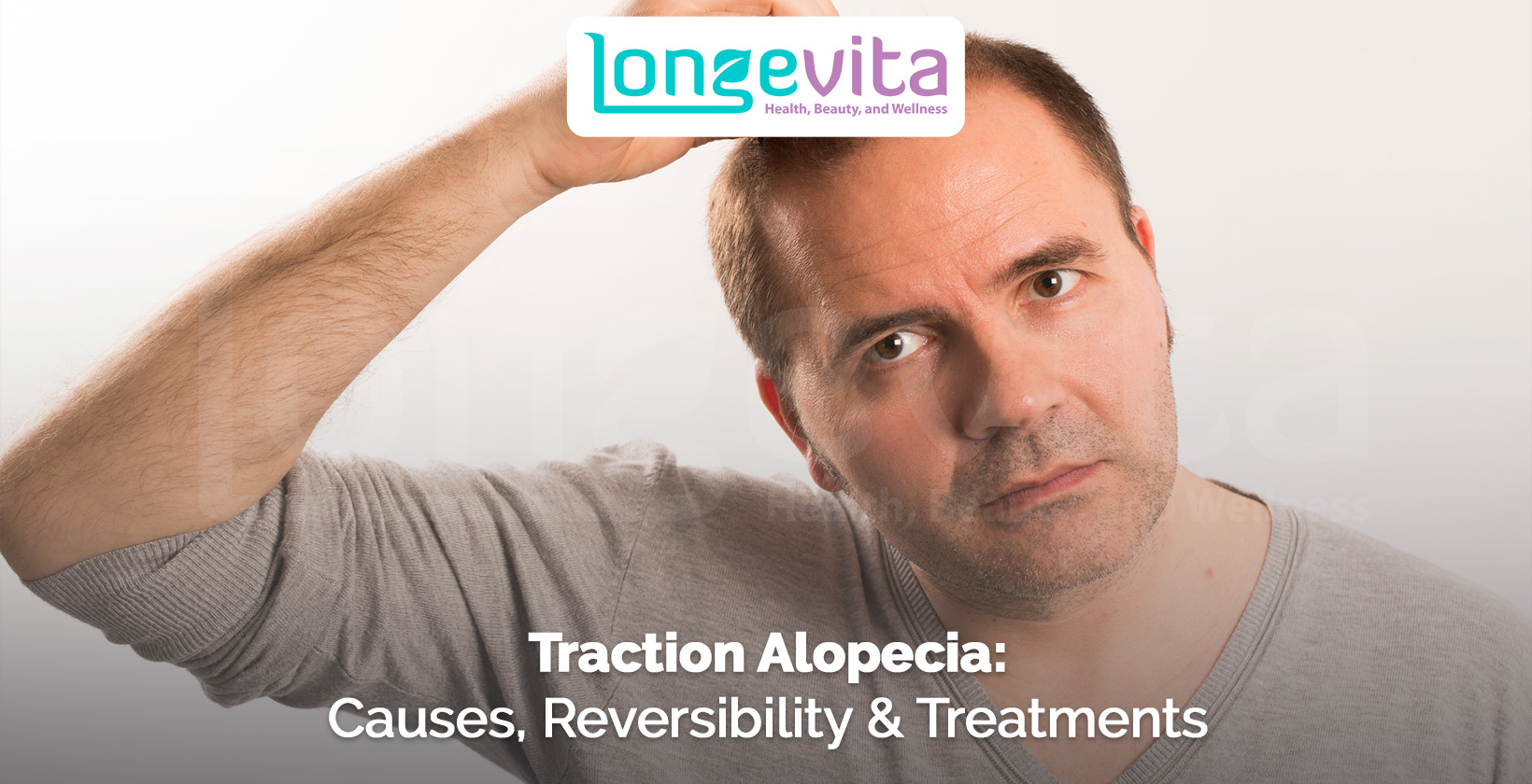 man lifting his hairline to show thinning scalp with text about traction alopecia