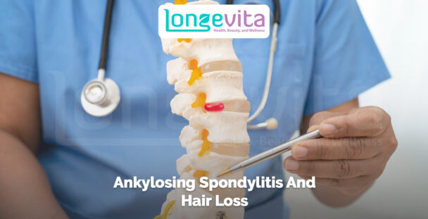 doctor pointing at a spine model with text ankylosing spondylitis and hair loss