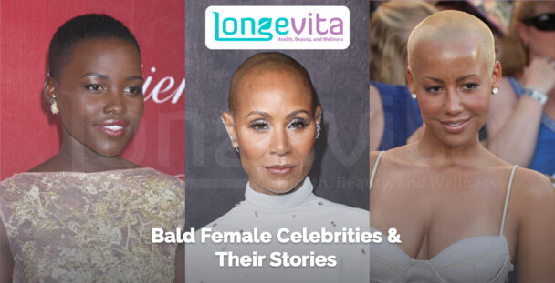 collage of three bald female celebrities with text about their hair loss stories