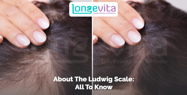 close-up of a woman’s scalp showing hair thinning with text about the ludwig scale
