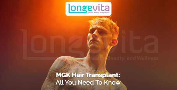 MGK shirtless on stage under orange lighting with text about hair transplant