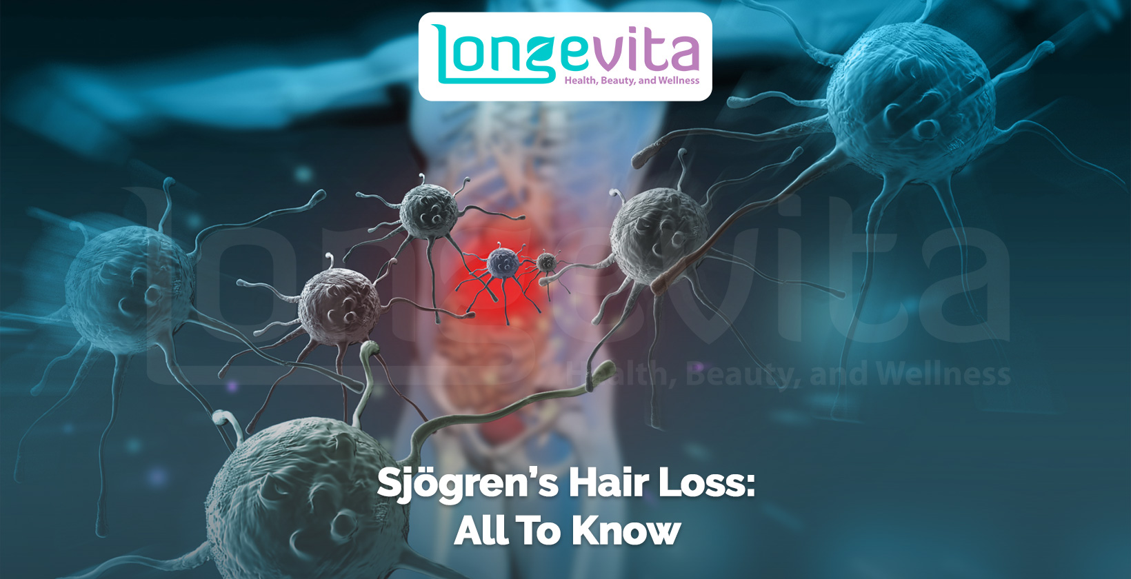 digital illustration of immune cells with text sjögren’s hair loss all to know