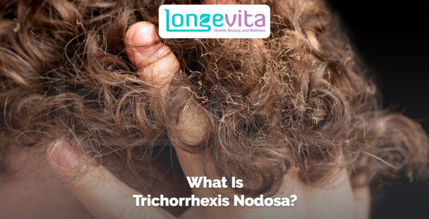 close-up of curly damaged hair with text about trichorrhexis nodosa