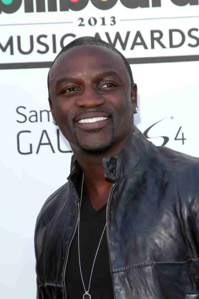 Akon's receding hairline