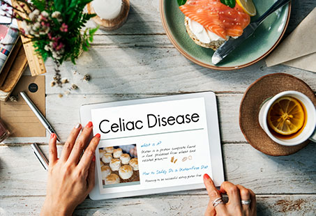 celiac disease hair loss