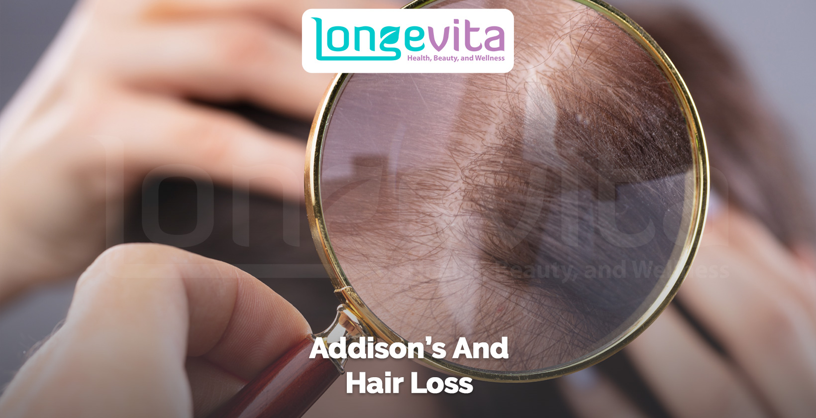 magnifying glass focusing on thinning hair with text addison’s and hair loss