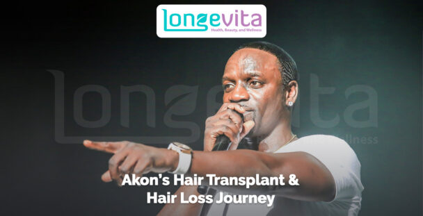 Akon performing on stage, pointing and holding mic, with text about his hair transplant journey