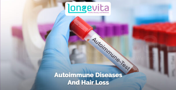 gloved hand holding a test tube labeled autoimmune test in a laboratory