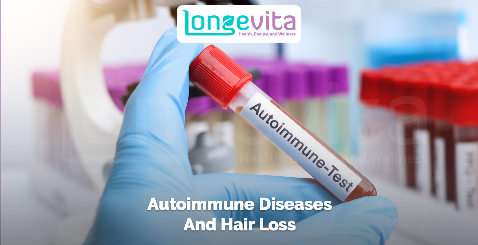 gloved hand holding a test tube labeled autoimmune test in a laboratory