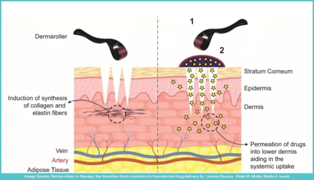 How derma rollers work