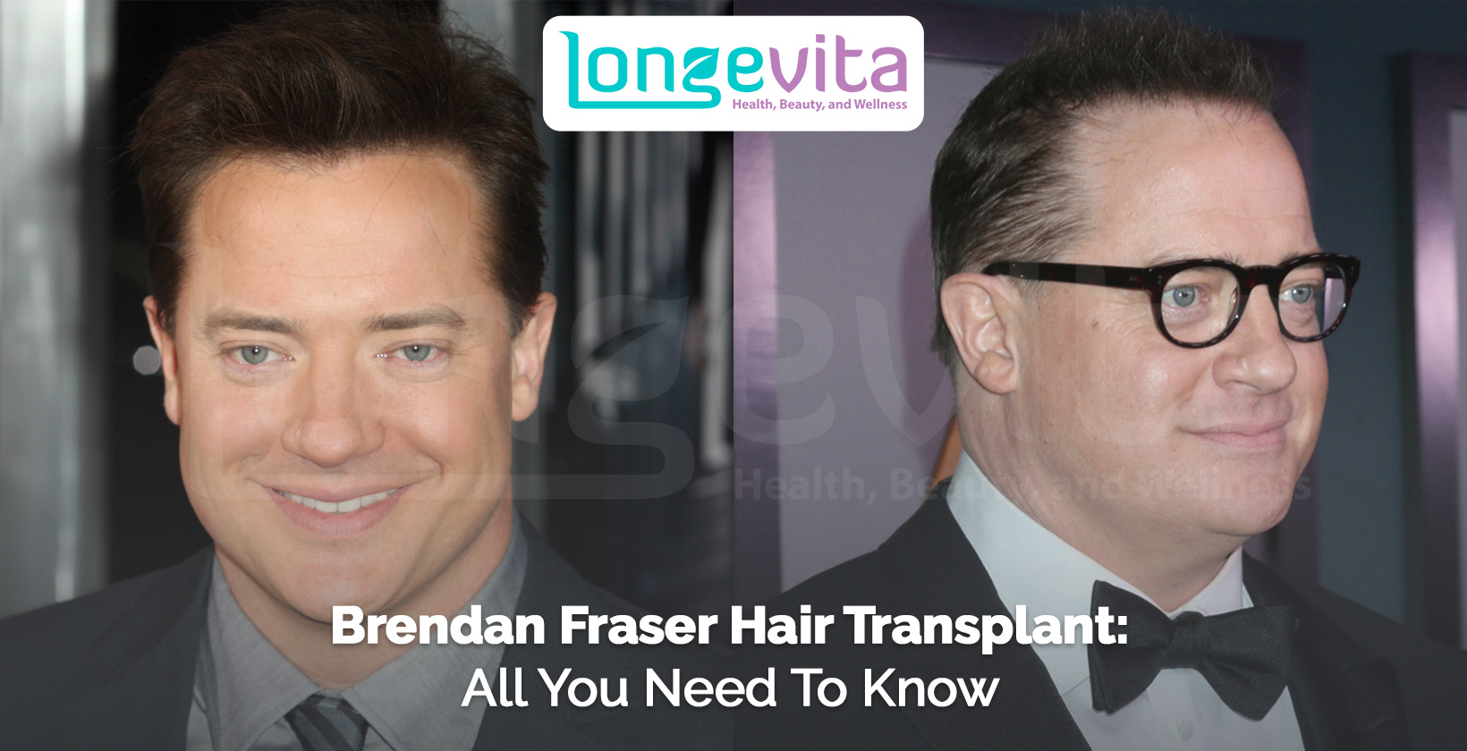 Brendan Fraser side-by-side comparison, highlighting hair transplant rumours and changes in appearance