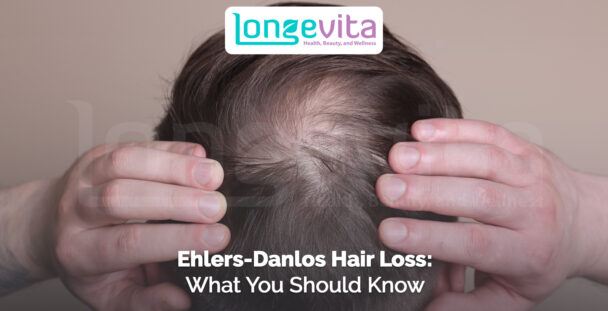 man parting thinning hair on scalp showing early signs of hair loss