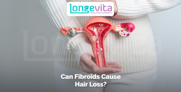 woman holding anatomical uterus model representing fibroids and hormonal changes