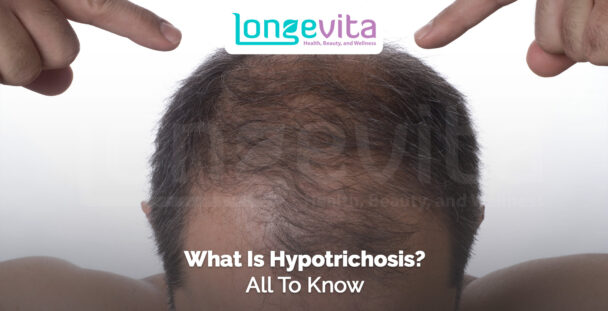 man with thinning hair on scalp showing signs of hair loss