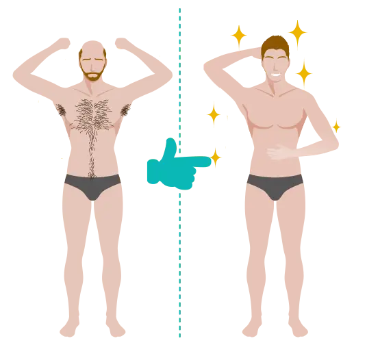 illustration showing before and after results of LHT body hair transplant in men