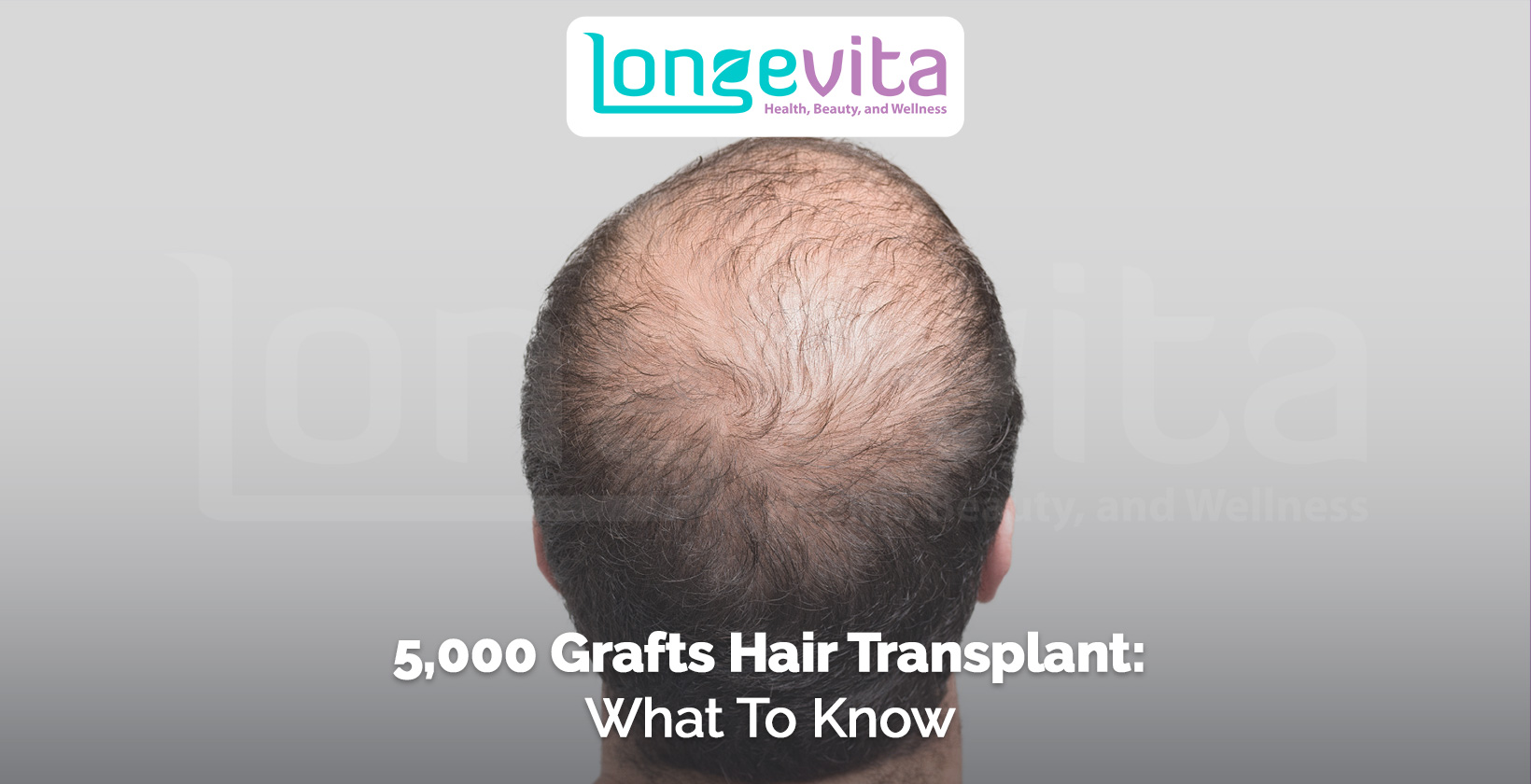 back view of a man with bald spots on the crown and thinning hair