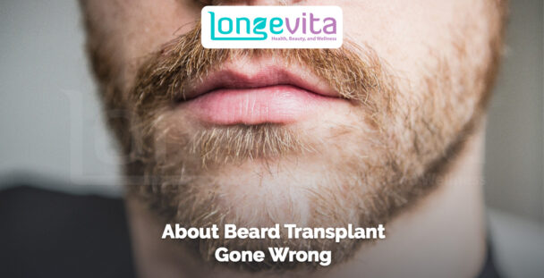 close-up of uneven beard hair growth after a beard transplant