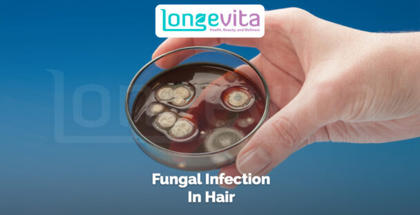 hand holding a petri dish with fungal colonies representing scalp infection