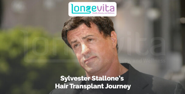 Sylvester Stallone looking thoughtful with text referencing his hair transplant journey