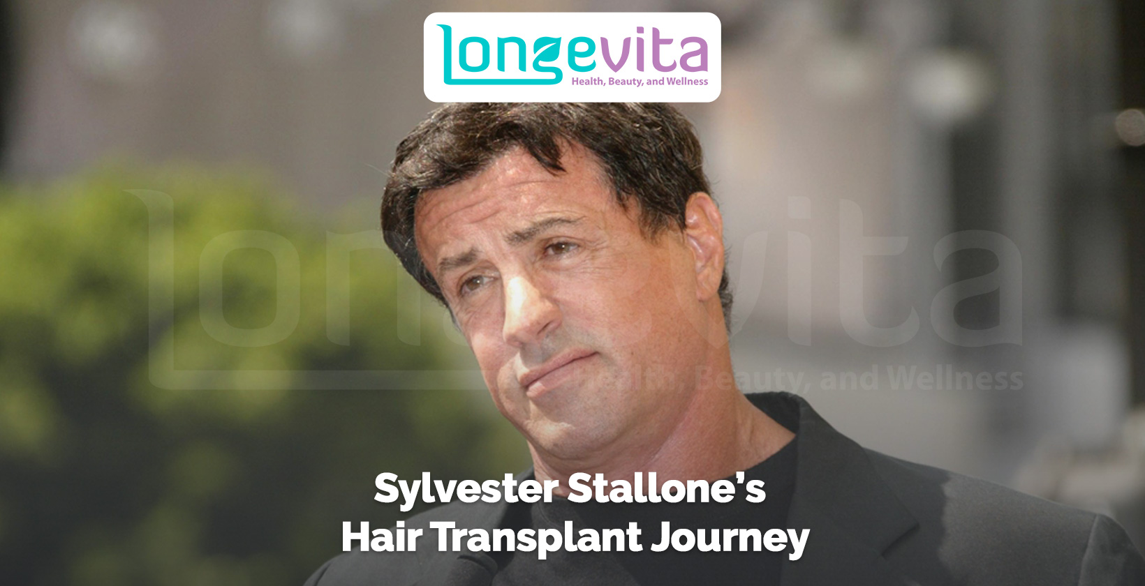 Sylvester Stallone looking thoughtful with text referencing his hair transplant journey