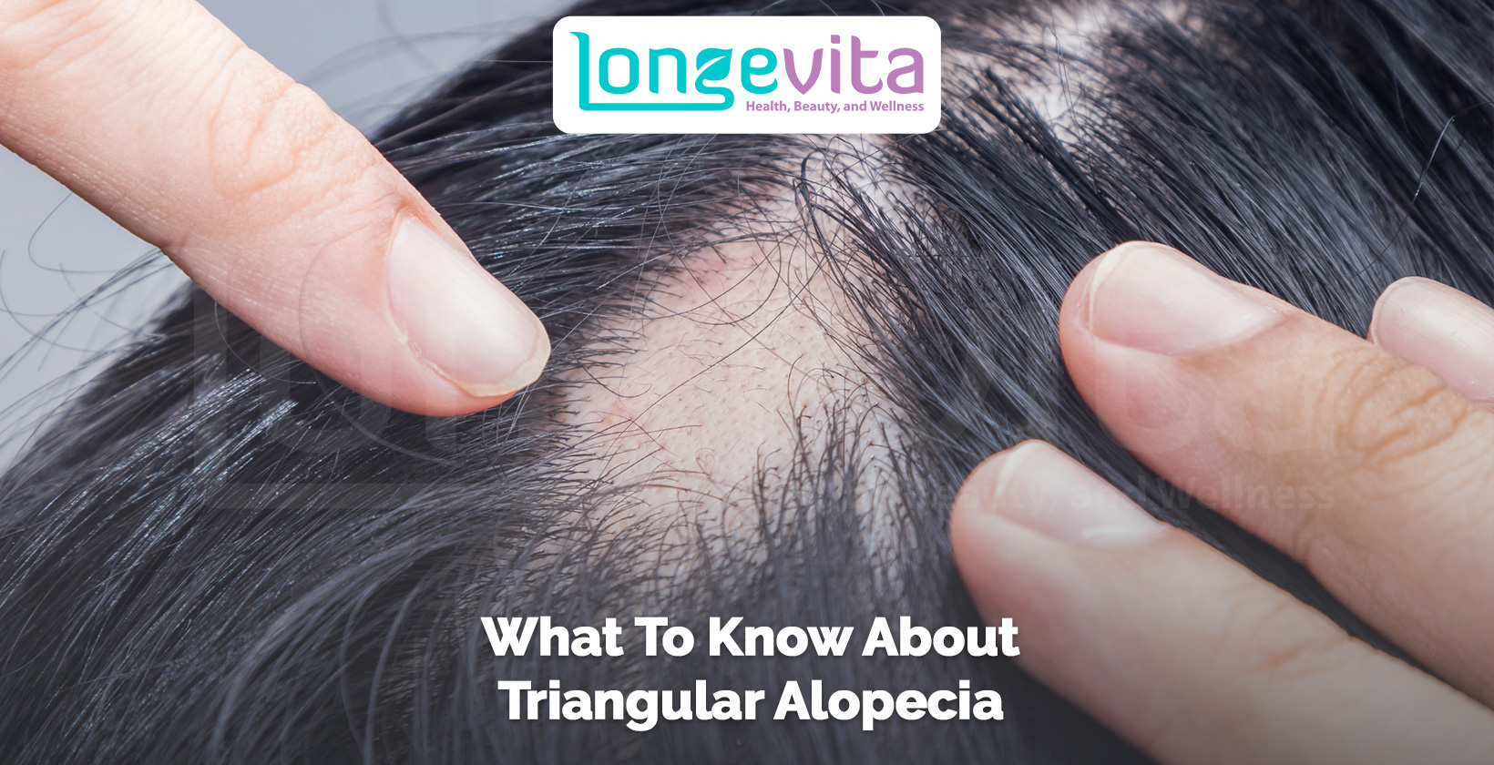 close-up of scalp with triangular bald patch being examined by fingers