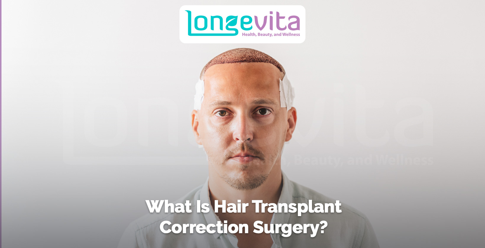 man with bandages and freshly transplanted hair after correction surgery