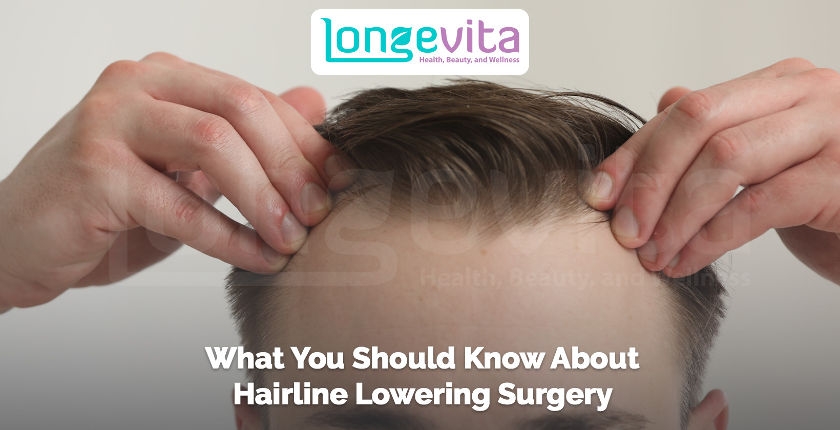 person showing forehead and hairline with text about lowering surgery