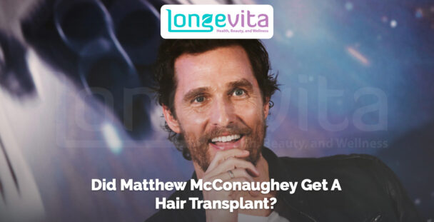 Smiling Matthew McConaughey with headline asking if he had a hair transplant