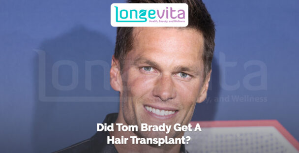 Smiling Tom Brady with headline questioning if he had a hair transplant